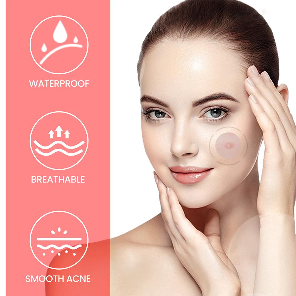 200 Pimple Patches